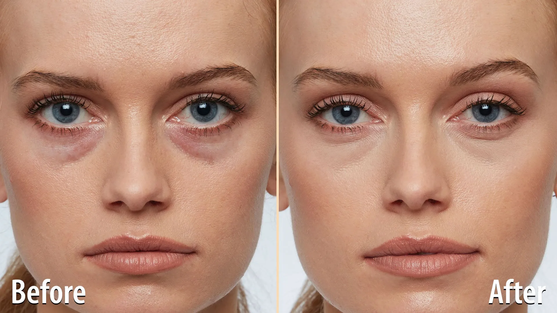 Age Reverse Concealer