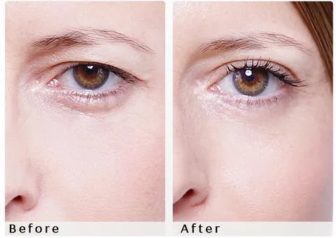 Magic Eyelid Tape