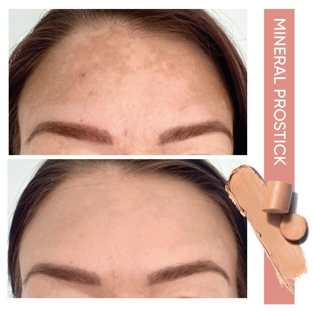 Mineral ProStick