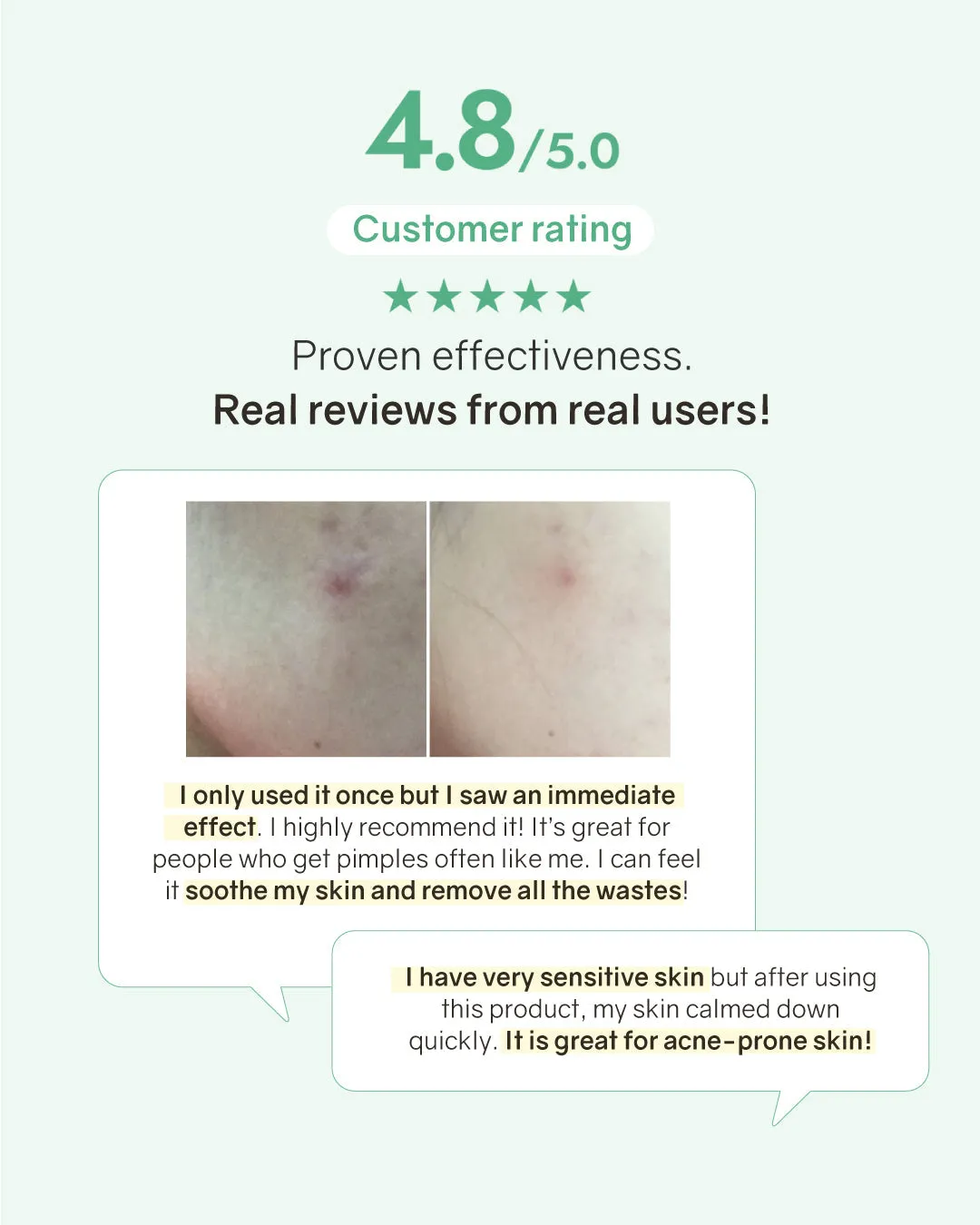 [PROMO] Bonabella Teatree Purifying Mask